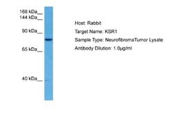 KSR1 Rabbit anti-Human, Polyclonal, Novus Biologicals 0.1 mL | Buy Online | Novus Biologicals | Fisher Scientific